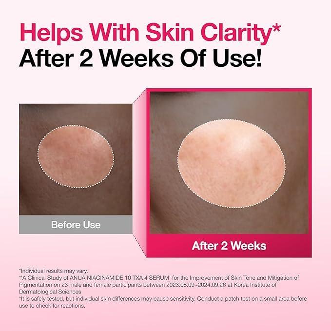 Anua Niacinamide 10 + TXA 4 Serum